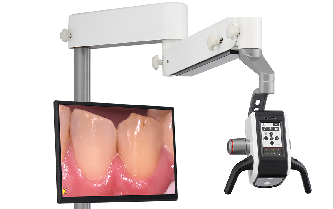 日本の歯科クリニックで精密治療に使用するマイクロスコープ